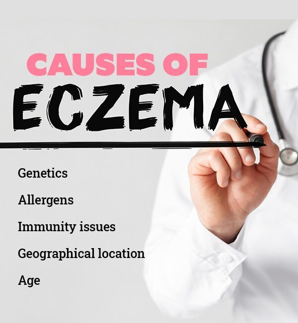 Eczema on the face: How to take care of the skin?