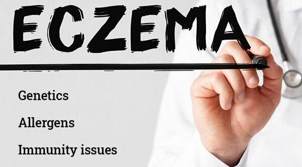Eczema on the face: How to take care of the skin?