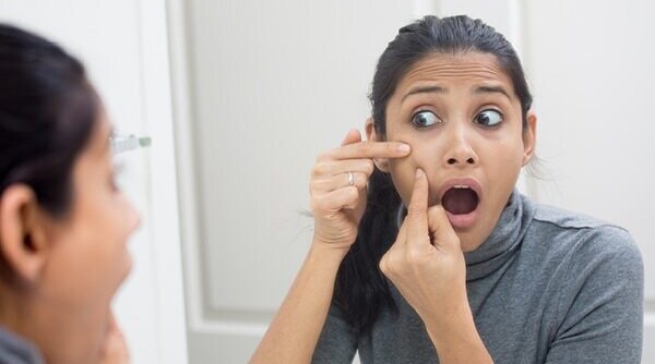 Acne Attack? Maybe You Can Try Using Garlic For Pimples!