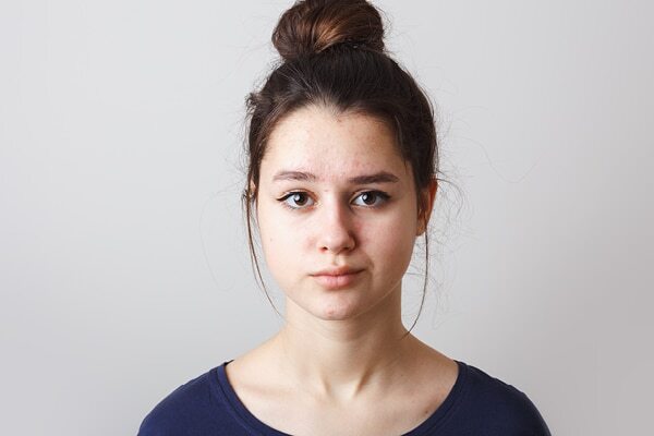 FAQs about sallow skin