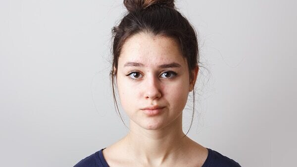 FAQs about sallow skin