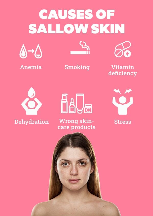 FAQs about sallow skin