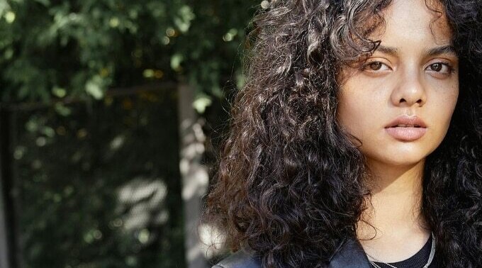 Banish The Itch: Home Remedies For Dandruff-Free Hair