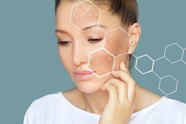 Benefits of benificial cream