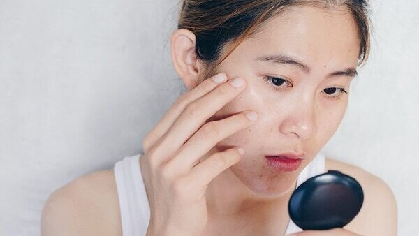 FAQ on Matcha Tea for Skin