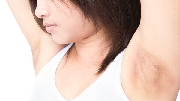 Dove Deodorants