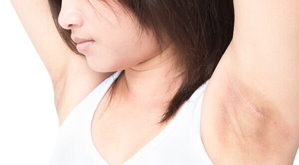 Dove Deodorants
