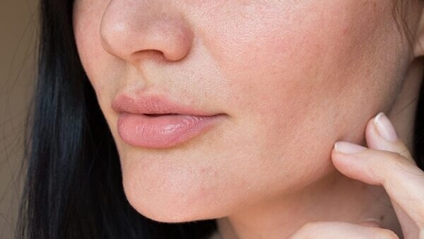 10. A simple regimen for sensitive skin