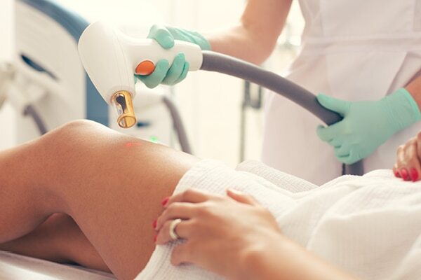 FAQs about stretch marks in teenagers