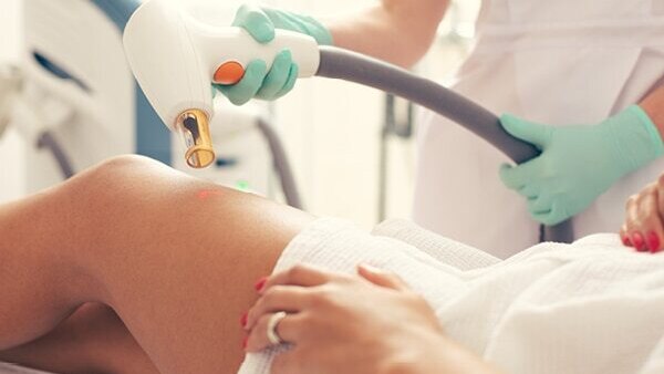 FAQs about stretch marks in teenagers