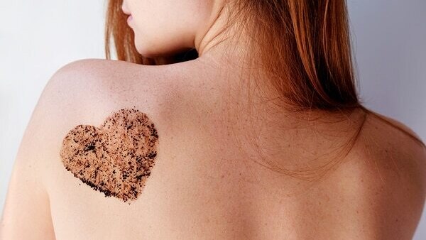 FAQs about stretch marks in teenagers