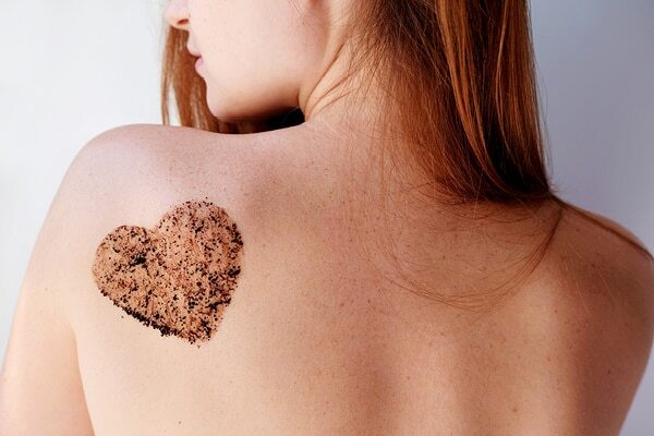 FAQs about stretch marks in teenagers