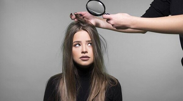 Dealing With Oily Dandruff: A Step-By-Step Manual