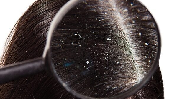 Pure derma shampoo: