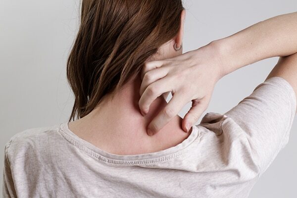 Cold sores - Common types of skin lesions