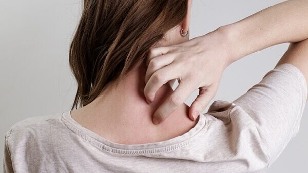 Cold sores - Common types of skin lesions