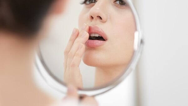 Cold sores - Common types of skin lesions
