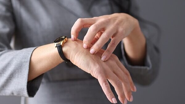 FAQs about scabies