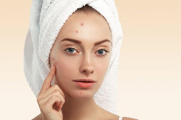 Frequently asked questions about how to remove whiteheads