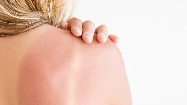 5.	Treatment of dandruff