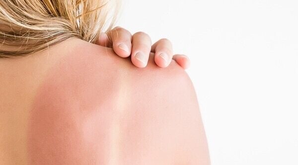 5.	Treatment of dandruff