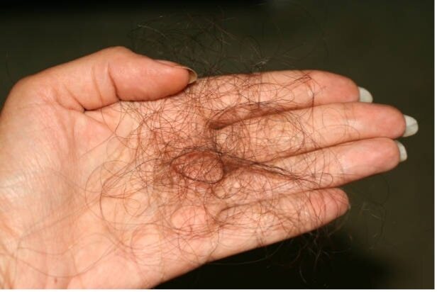 3. Curd + curry leaves hair mask