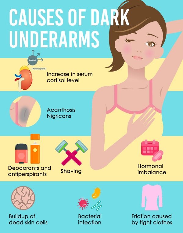 Medical treatments for underarm lightening