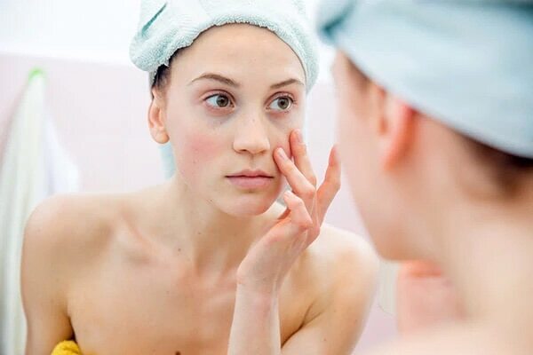 #4 Heals Dry Skin Problems
