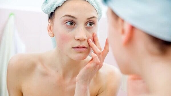 #4 Heals Dry Skin Problems