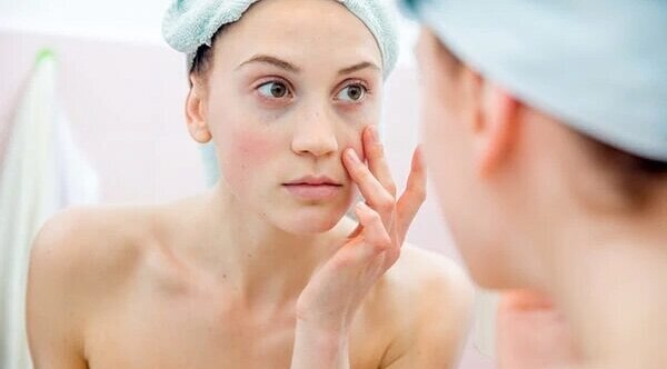 #4 Heals Dry Skin Problems