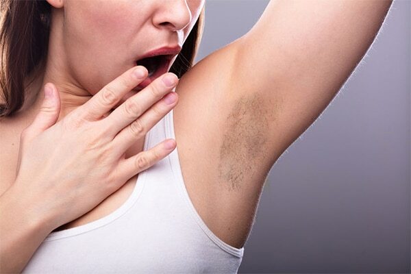 Medical treatments for underarm lightening