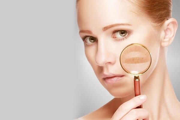 #4 Heals Dry Skin Problems