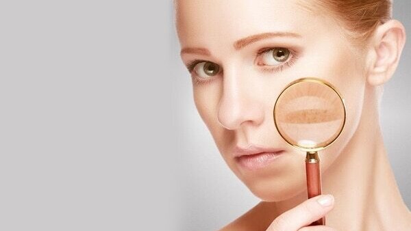 #4 Heals Dry Skin Problems
