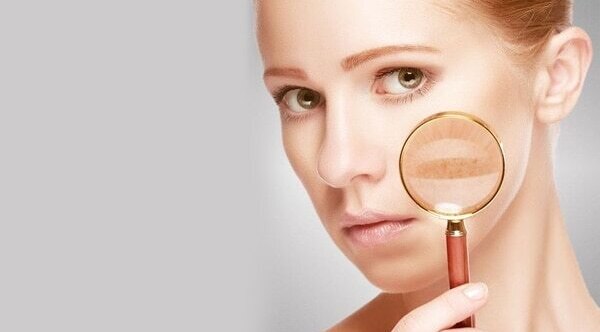 #4 Heals Dry Skin Problems