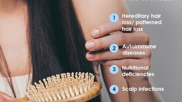 FAQs about minoxidil for women