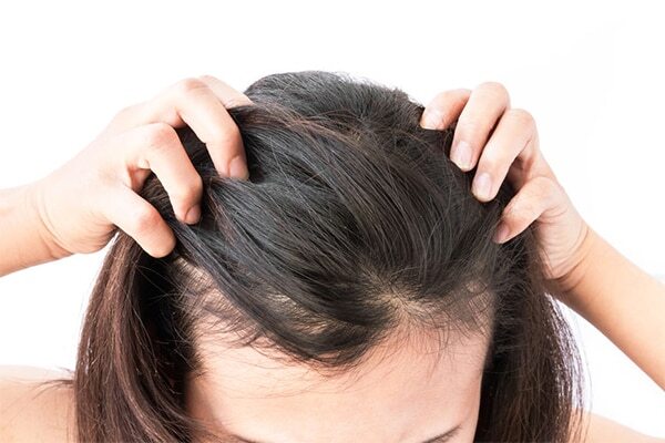 FAQs about minoxidil for women