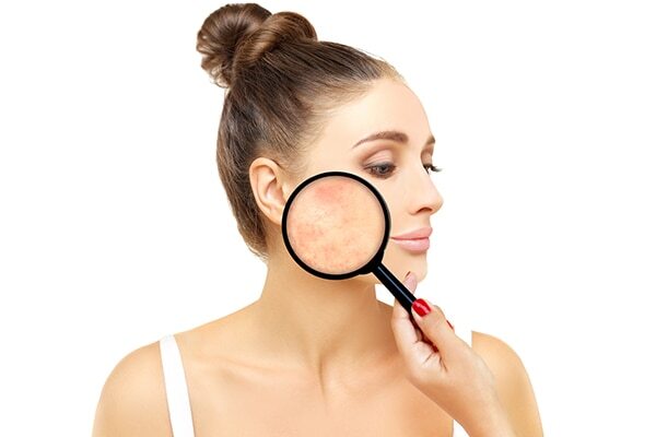 Benefit #05: Helps shrink pores