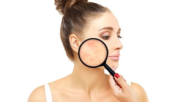 Benefit #05: Helps shrink pores