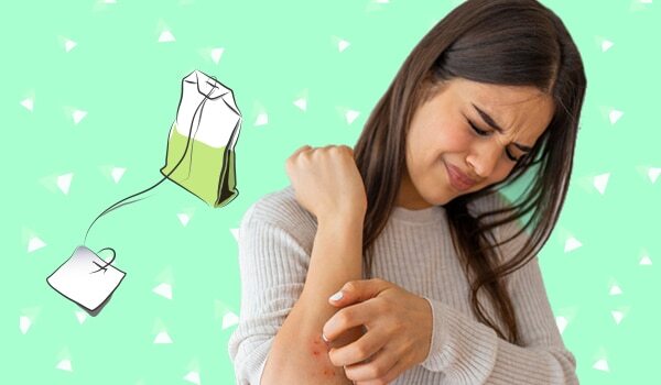A Teabag Can Heal Post-Wax Itching And Redness. Here’s How!