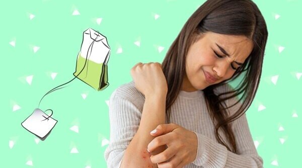A Teabag Can Heal Post-Wax Itching And Redness. Here’s How!