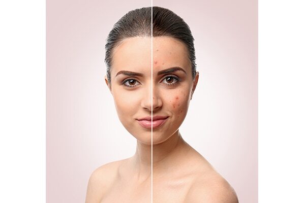 #05: Moisturises skin