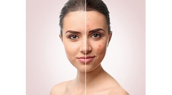 #05: Moisturises skin