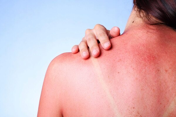 Benefits is apple cider vinegar - Has anti-ageing properties