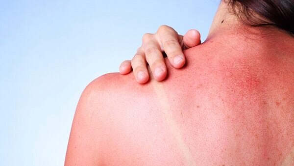 Benefits is apple cider vinegar - Has anti-ageing properties