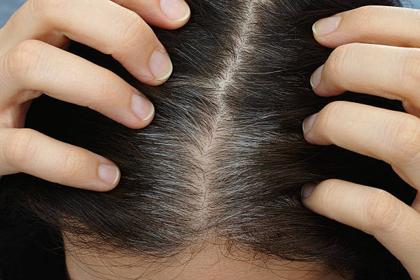 Kiwi Fruit Benefits for Skin, Hair and Health