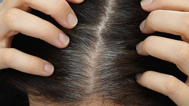 Kiwi Fruit Benefits for Skin, Hair and Health