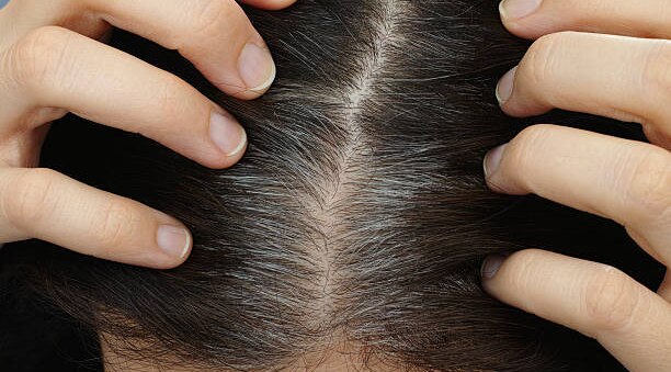 Kiwi Fruit Benefits for Skin, Hair and Health
