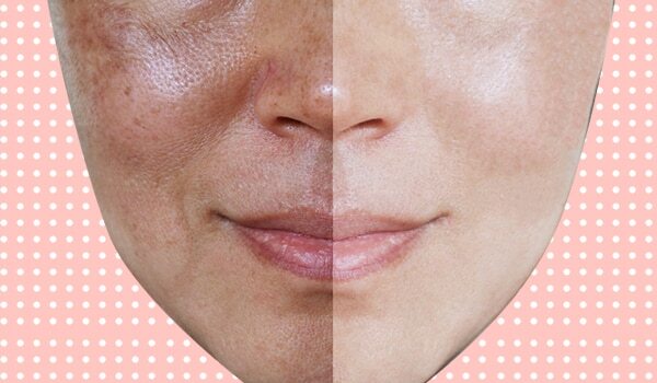 The Skincare Routine You Need to Help Minimise The Appearance Of Open Pores