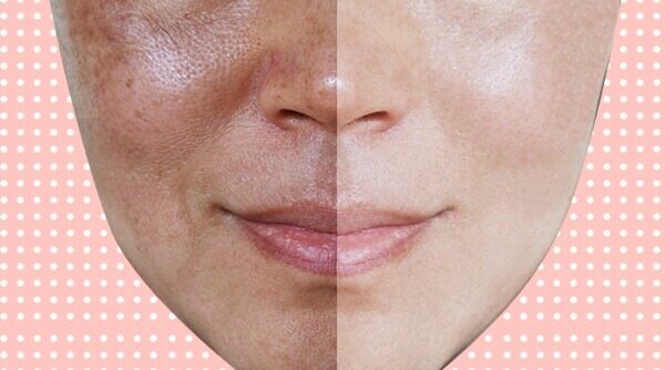The Skincare Routine You Need to Help Minimise The Appearance Of Open Pores