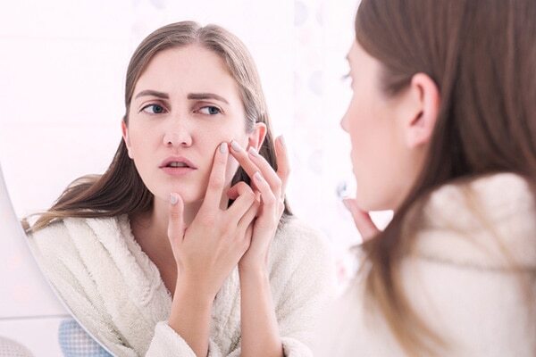 5) Parabens